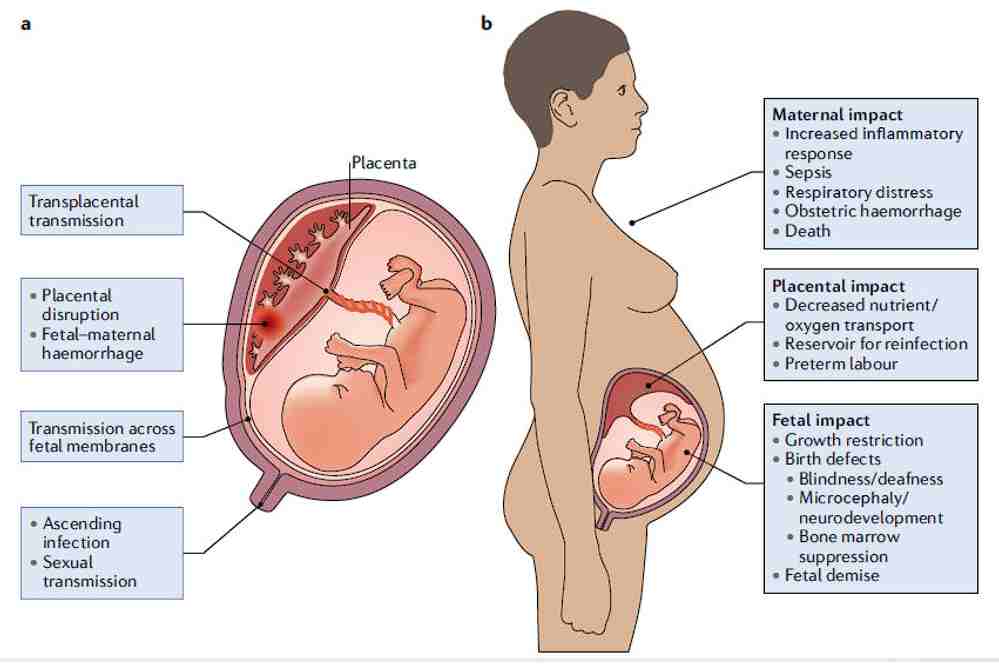 agente antibacteriano podría causar problemas durante el embarazo